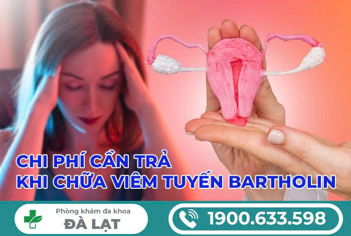 Hình ảnh minh họa